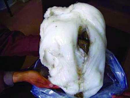 地球上发现的第四生命体 太岁“肉灵芝”