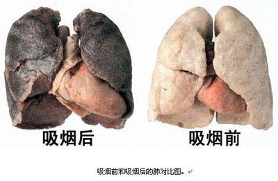 公益广告 吸烟者的肺部照片