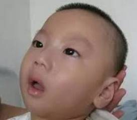 警惕樟脑丸对儿童的伤害文章插图